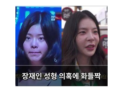 장재인 성형 의혹에 화들짝