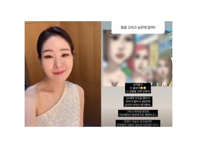 미자 성형수술 언급해 화제 되는 듯