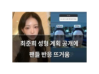 최준희 성형 계획 공개에 팬들 반응 뜨거움