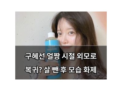 구혜선 얼짱 시절 외모로 복귀? 살 뺀 후 모습 화제
